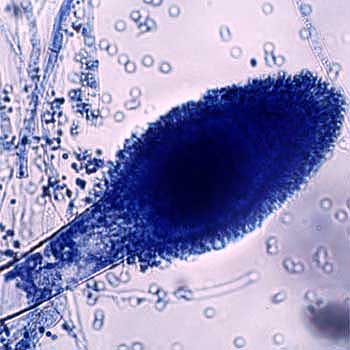 Aspergillus clavatus